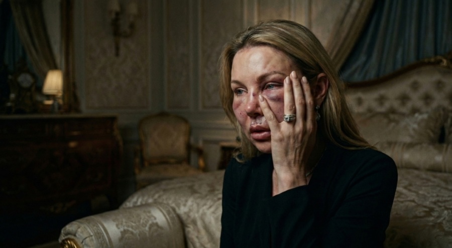 Sosyetede "Yılan Zehri" Kâbusu: Gençleşme Hayali Faciayla Bitti!